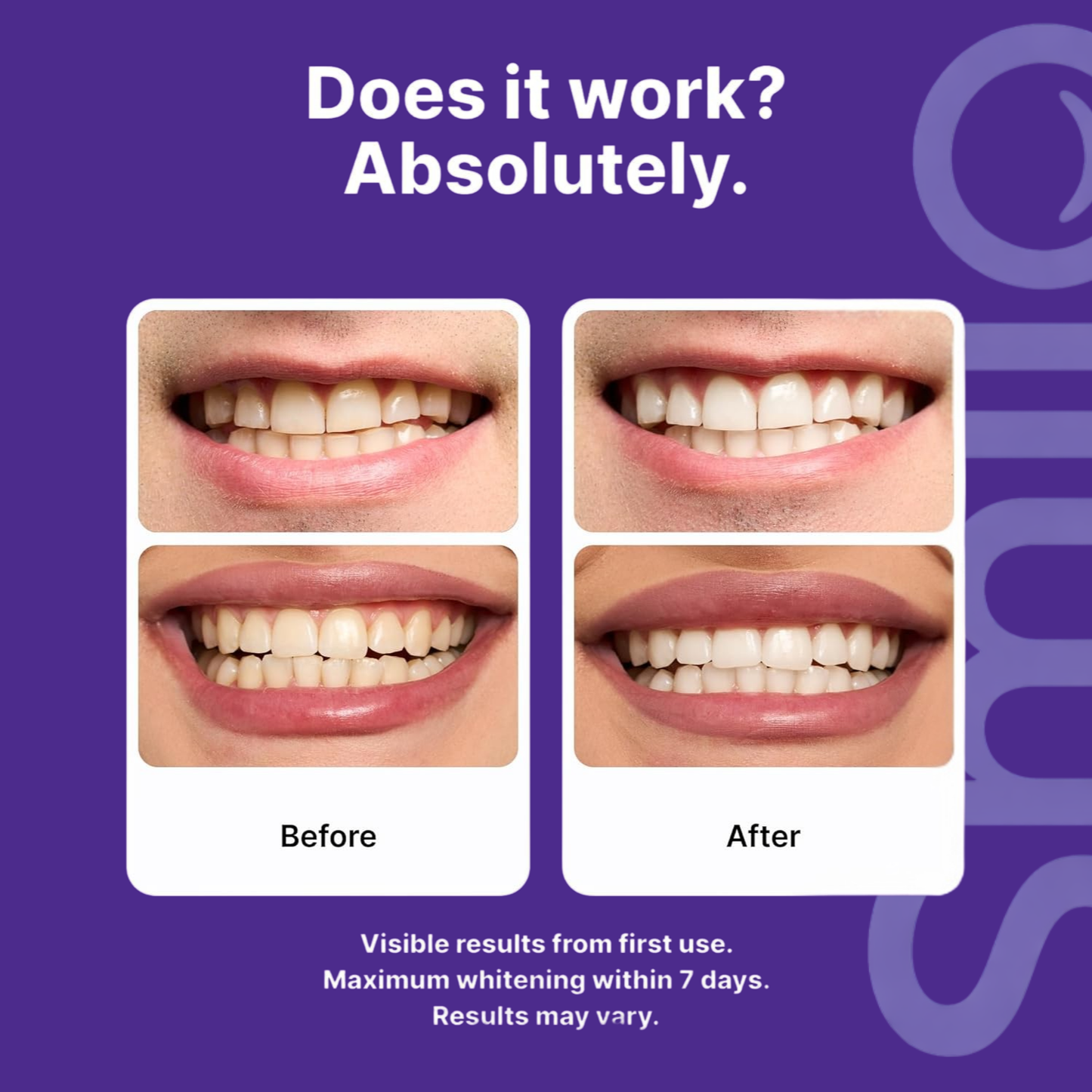 Transform Your Smile in One Use