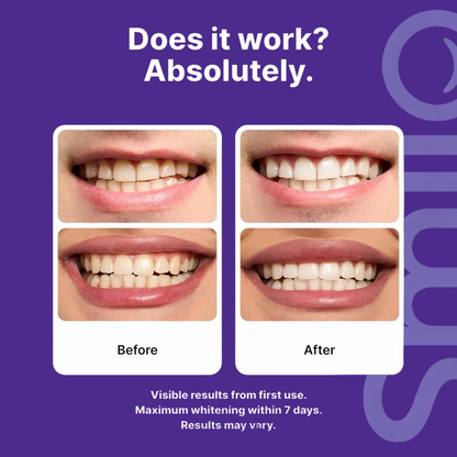 Transform Your Smile in One Use